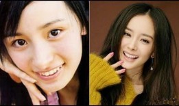 明星爆料整容视频大全最新,明星整容真相大曝光，视频大全揭秘美丽背后的秘密